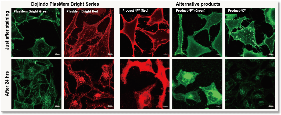 Track The Dynamics Of Plasma Membrane